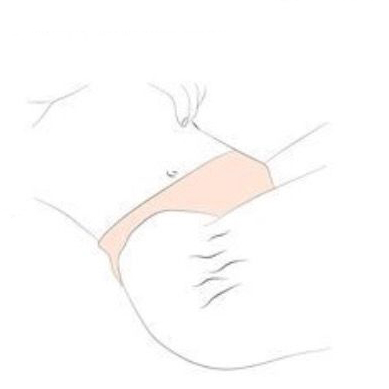 Marine Hydrolyzed Collagen Peptides Protein for Stretch Marks